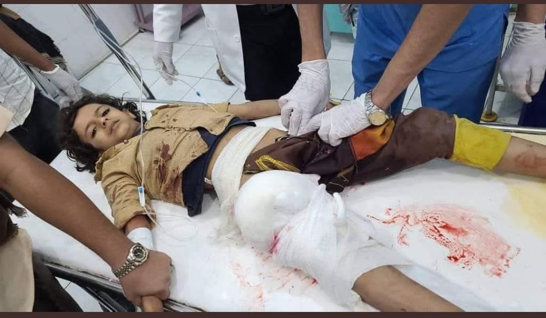 الأطفال في اليمن