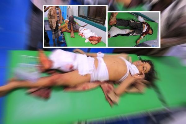 جرائم حرب في اليمن