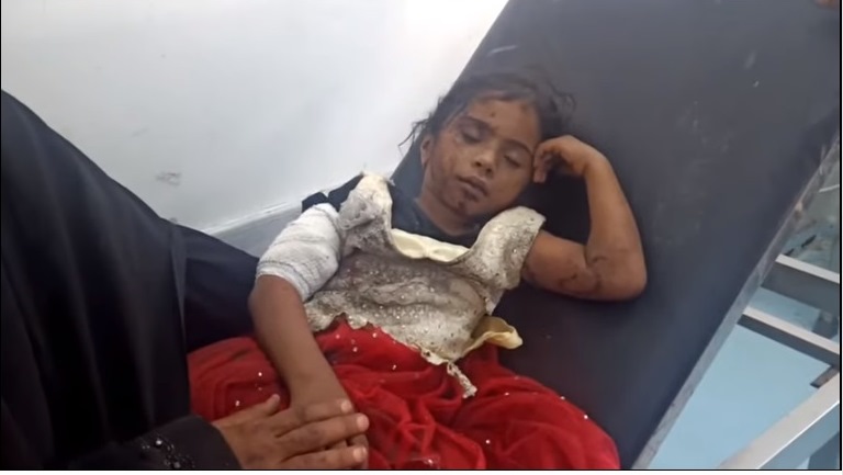 الحديدة .. إصابة امرأة مسنّة وطفلة بانفجار لغم حوثي في مديرية جبل راس